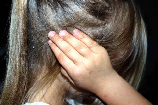 girl child hidden face in hair bruised hands over ears.